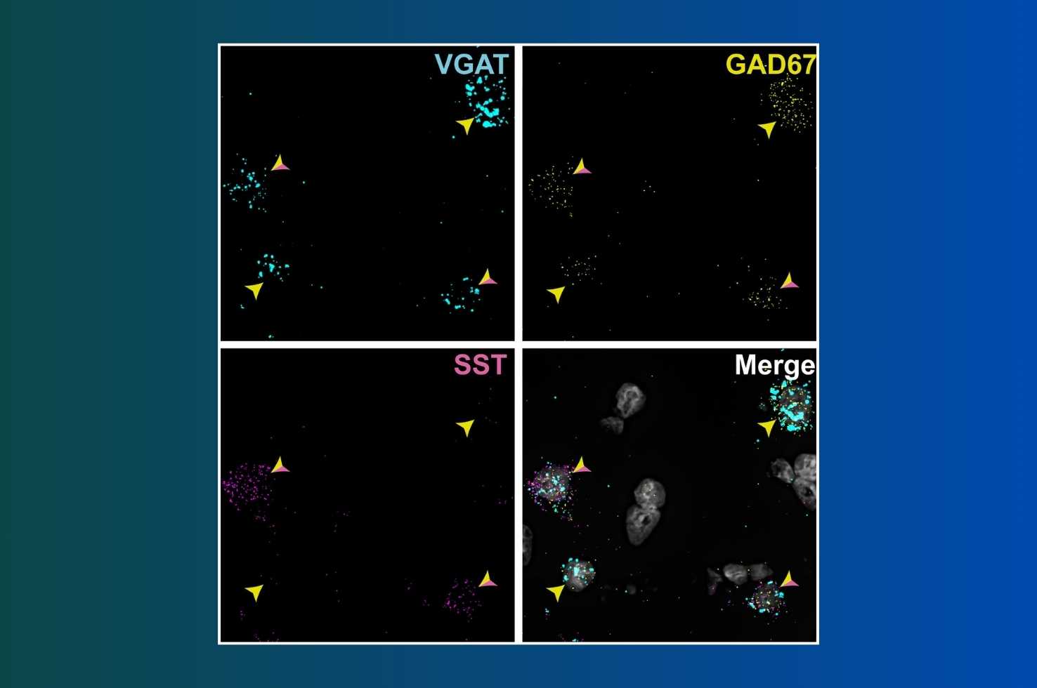 Image of Cortical Somatostatin Neurons Image of Cortical Somatostatin Neurons