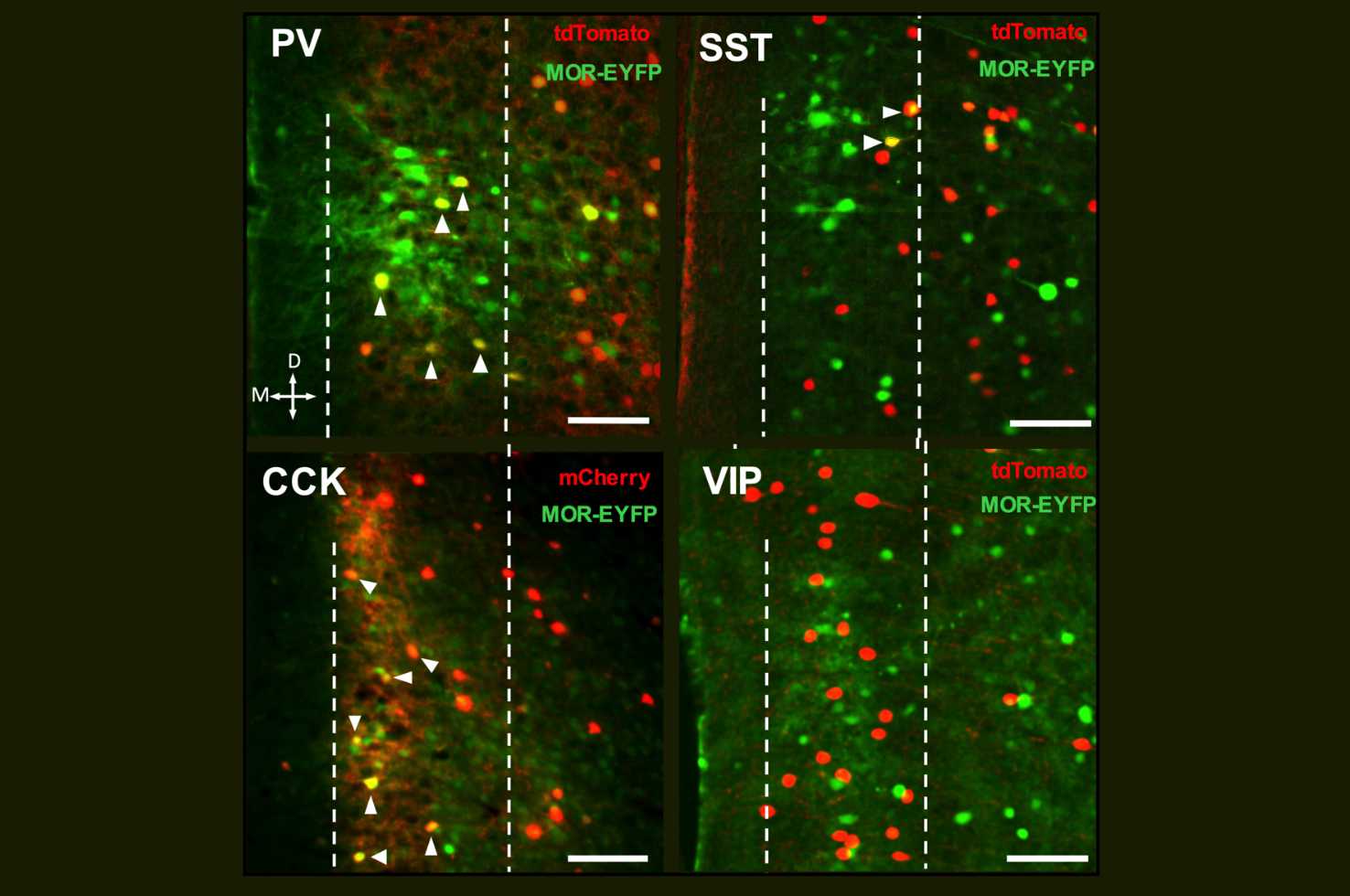 Image from Joffe et al. Journal of Neuroscience 2025