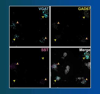 Image of Cortical Somatostatin Neurons