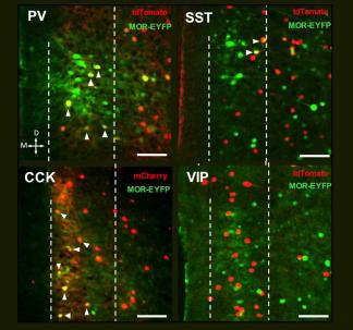 Image from Joffe et al. Journal of Neuroscience 2025